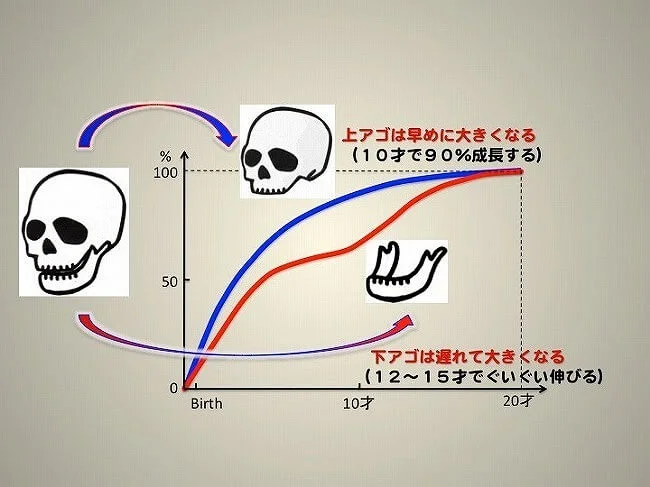 （図３）上顎骨（上アゴ）と下顎骨（下アゴ）の成長スピードの違いをイメージしたものです。