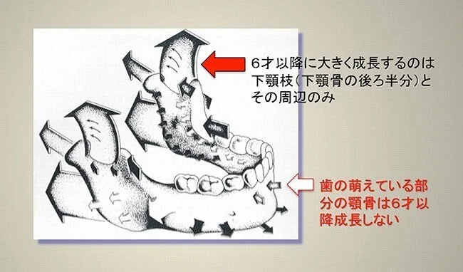 （図５）６才以降は下顎枝が主に成長する